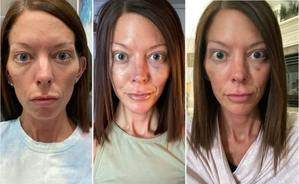 Before and after pictures