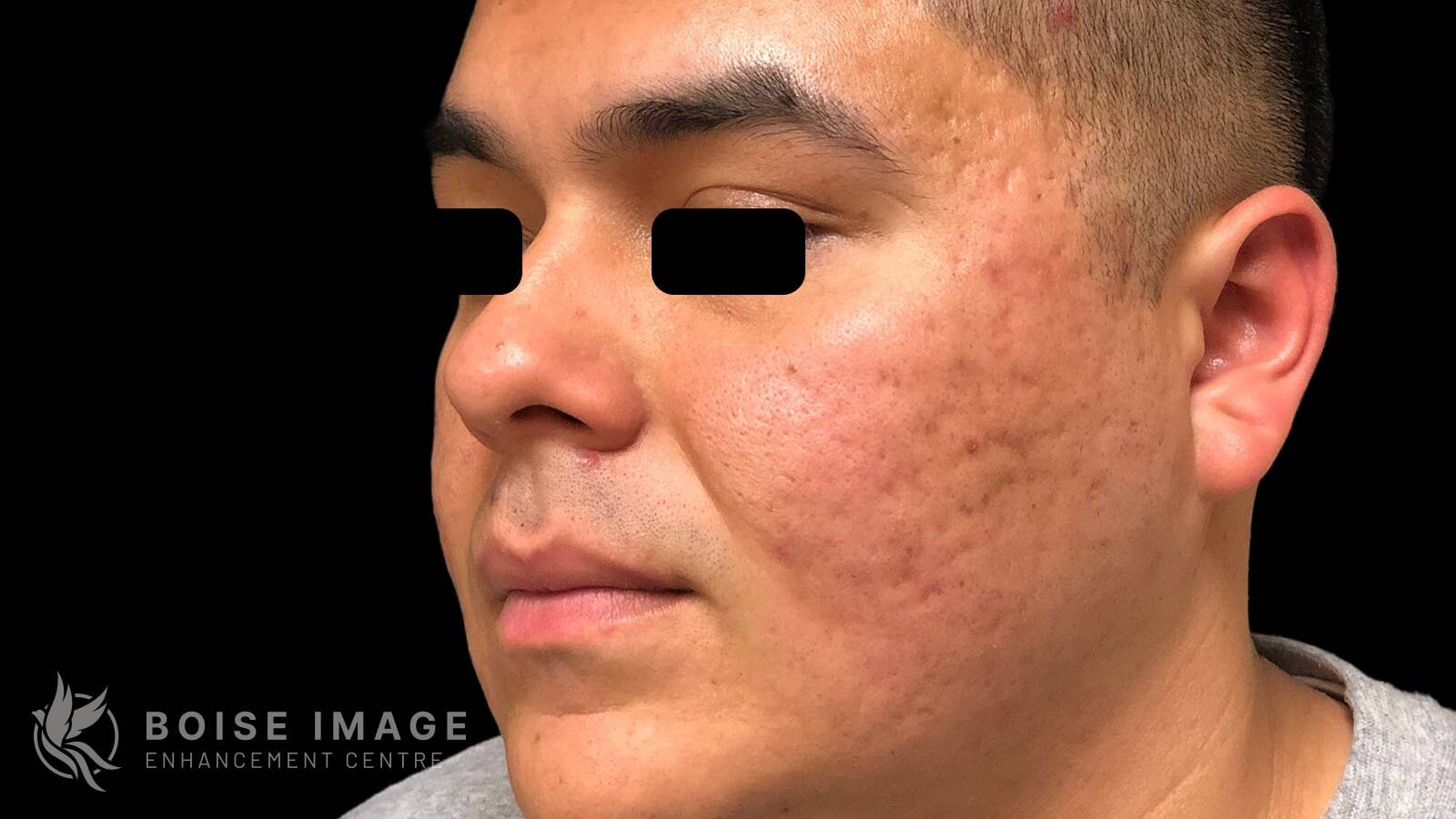 Face After