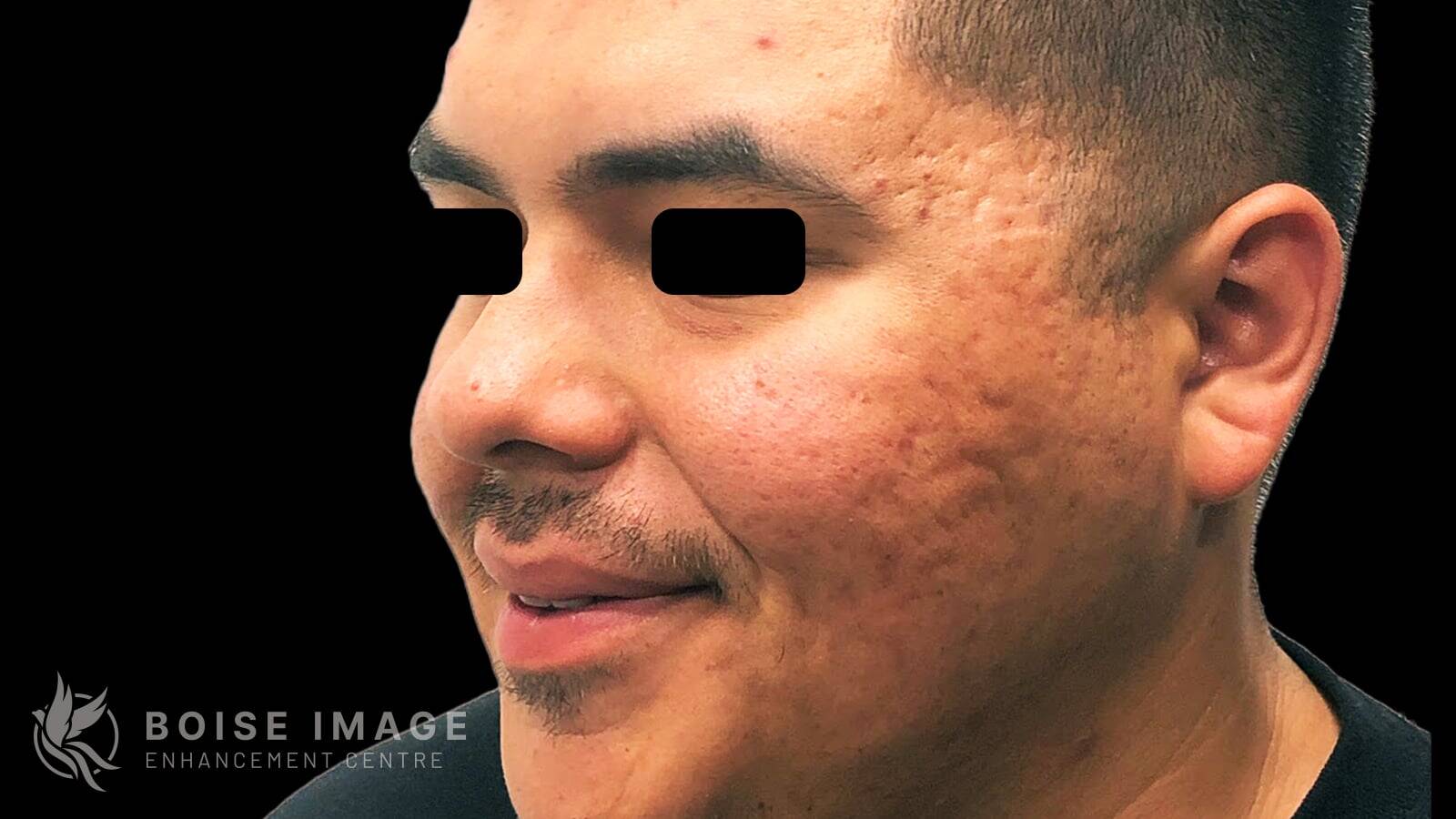 Face Before