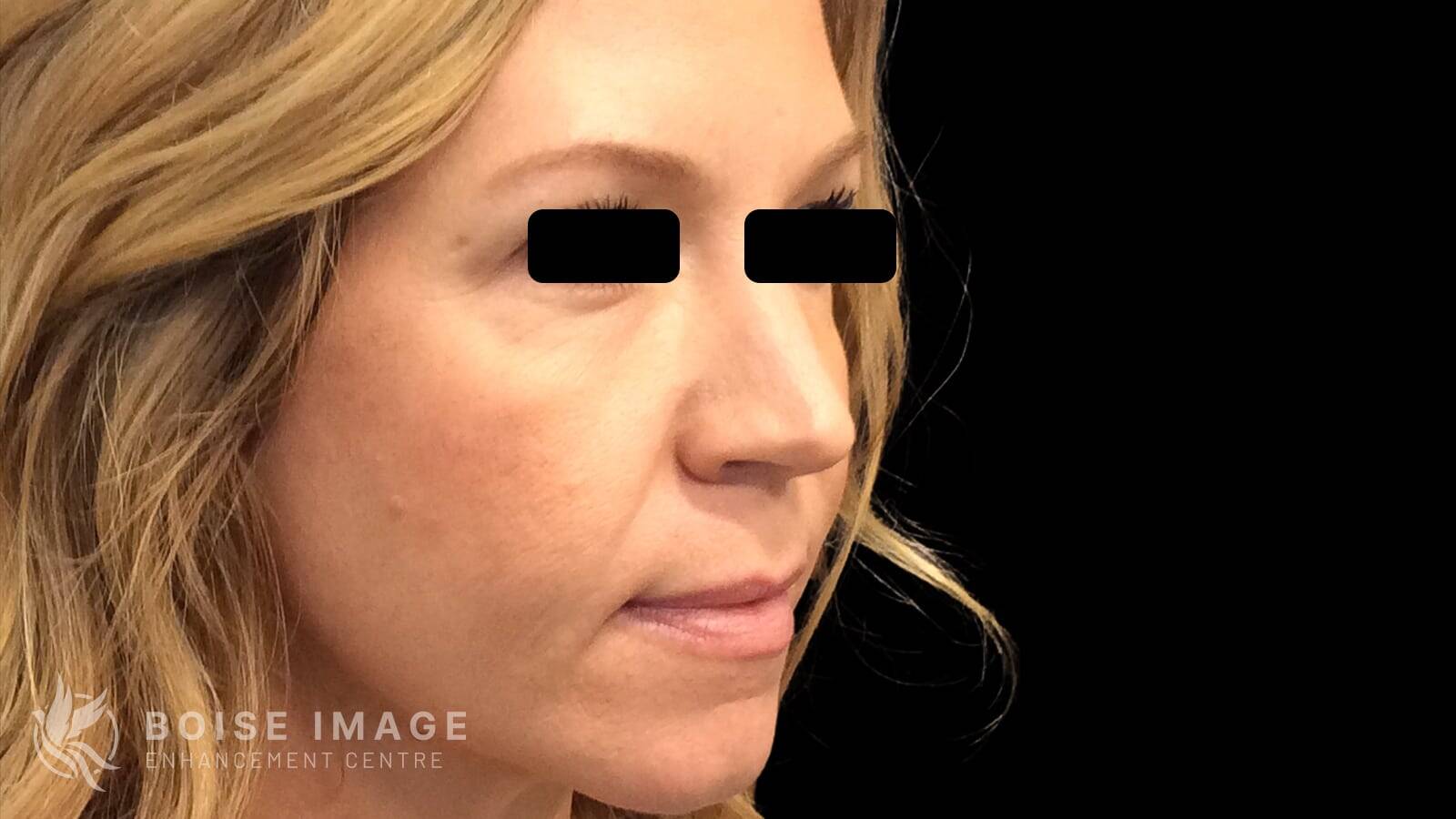 Light Lift Before