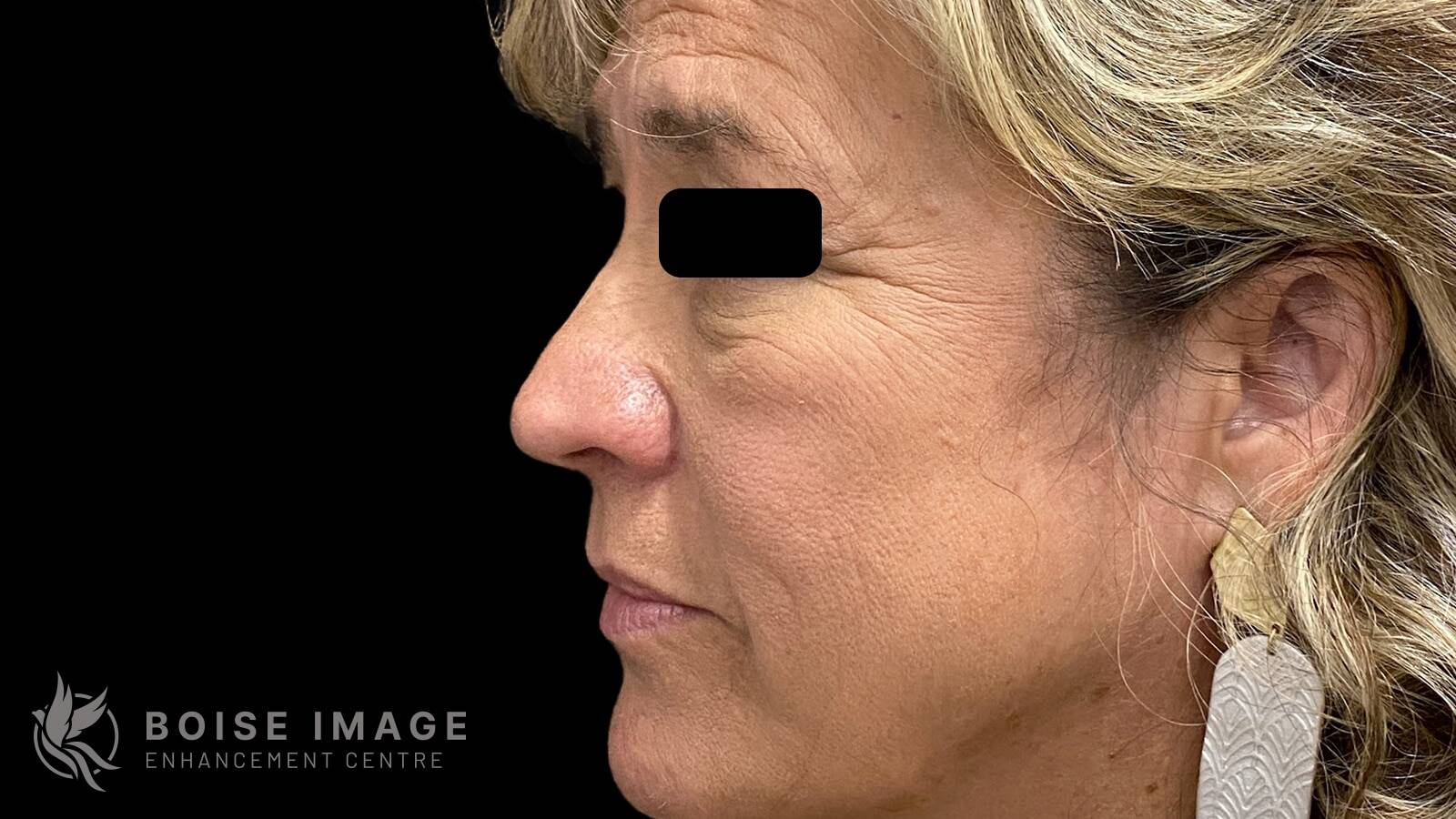 Light Lift Before