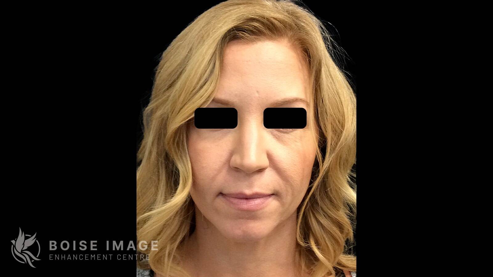Light Lift Before