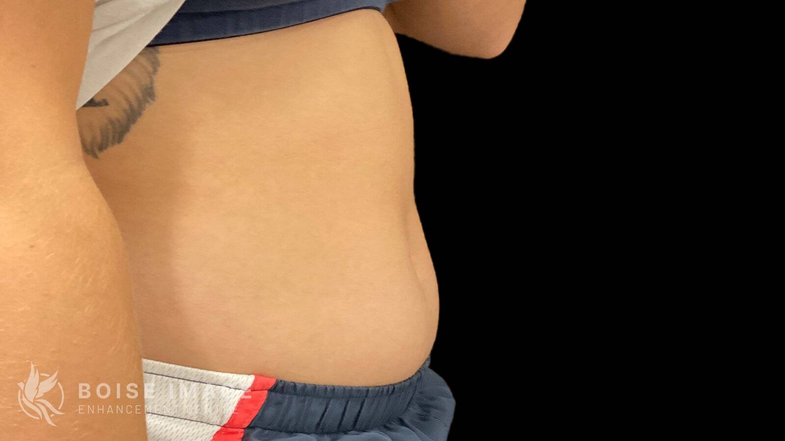 Stomach Before