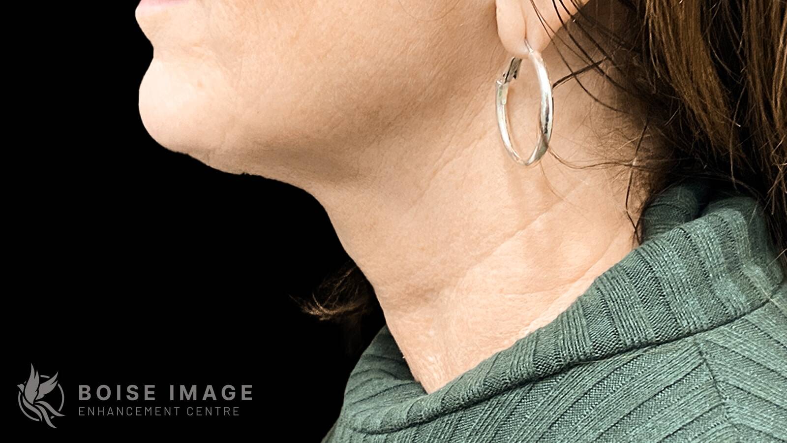 Neck Before